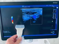 Ultrasuono GE Logiq E9 XDclear