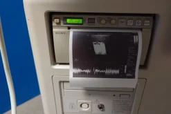Ultrasuono PHILIPS HD7 XE