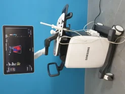 Ultrasuono SAMSUNG UGEO H60