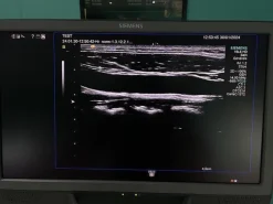 Ultrasuono SIEMENS ACUSON S2000 HELX Evoluzione
